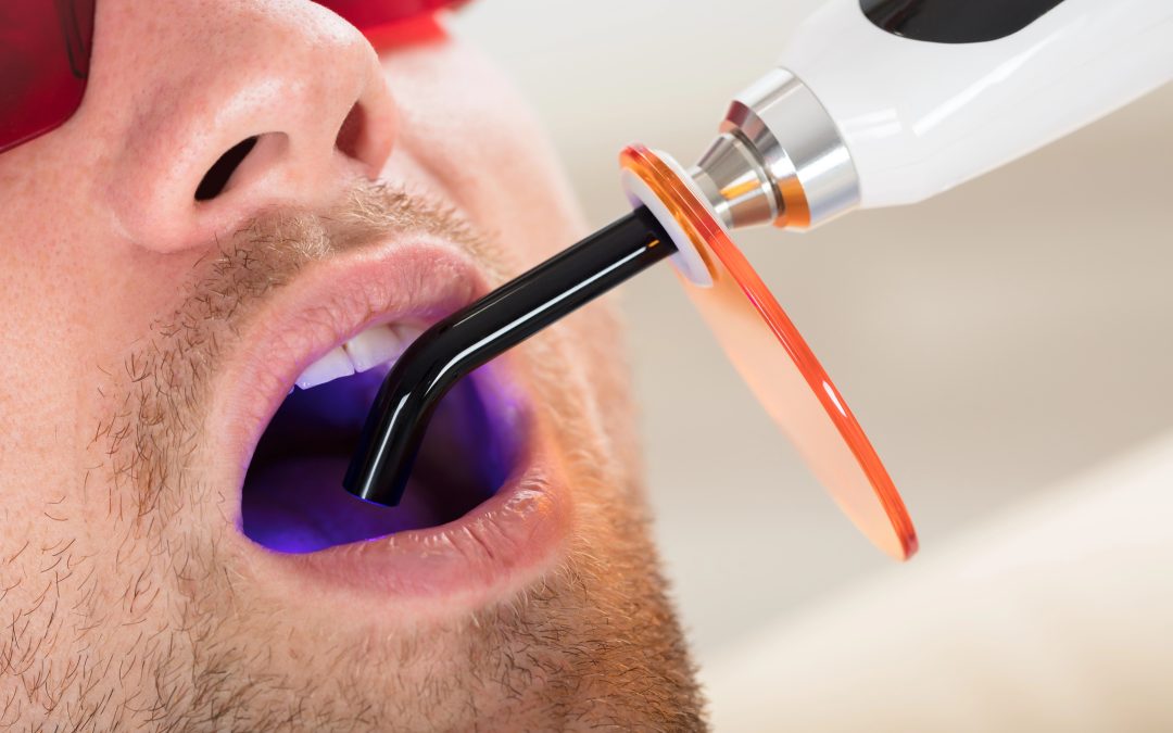 Dental Filling Longevity Guide: How Long Do They Really Last?