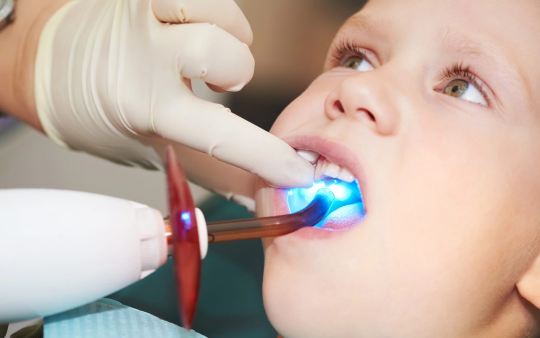 Dental Filling for Cavities: Restoring Strength and Health